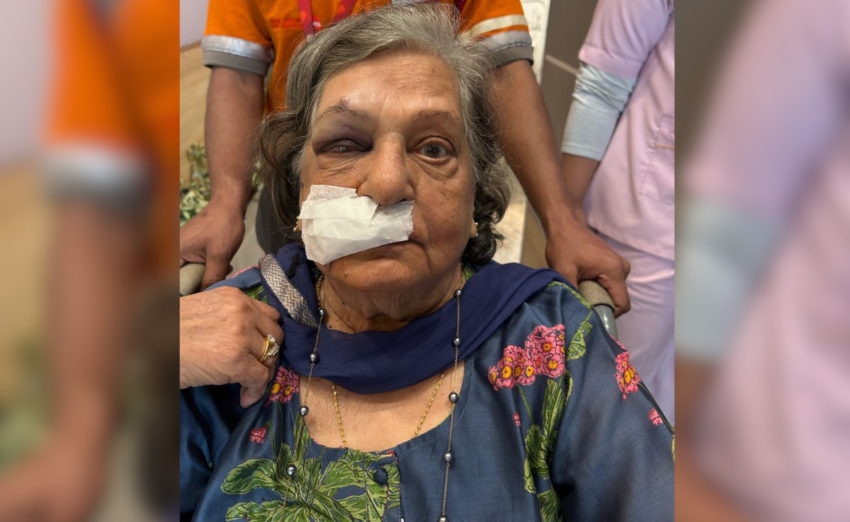 Denied Wheelchair By Air India, 82-Year-Old Woman Falls, Lands In Hospital